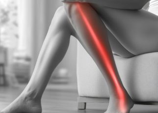 Ciática